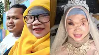 Kabar Terbaru Ayu Korban Kecelakan Mesin Perahu, Kini Sudah Temukan Cinta Sejati