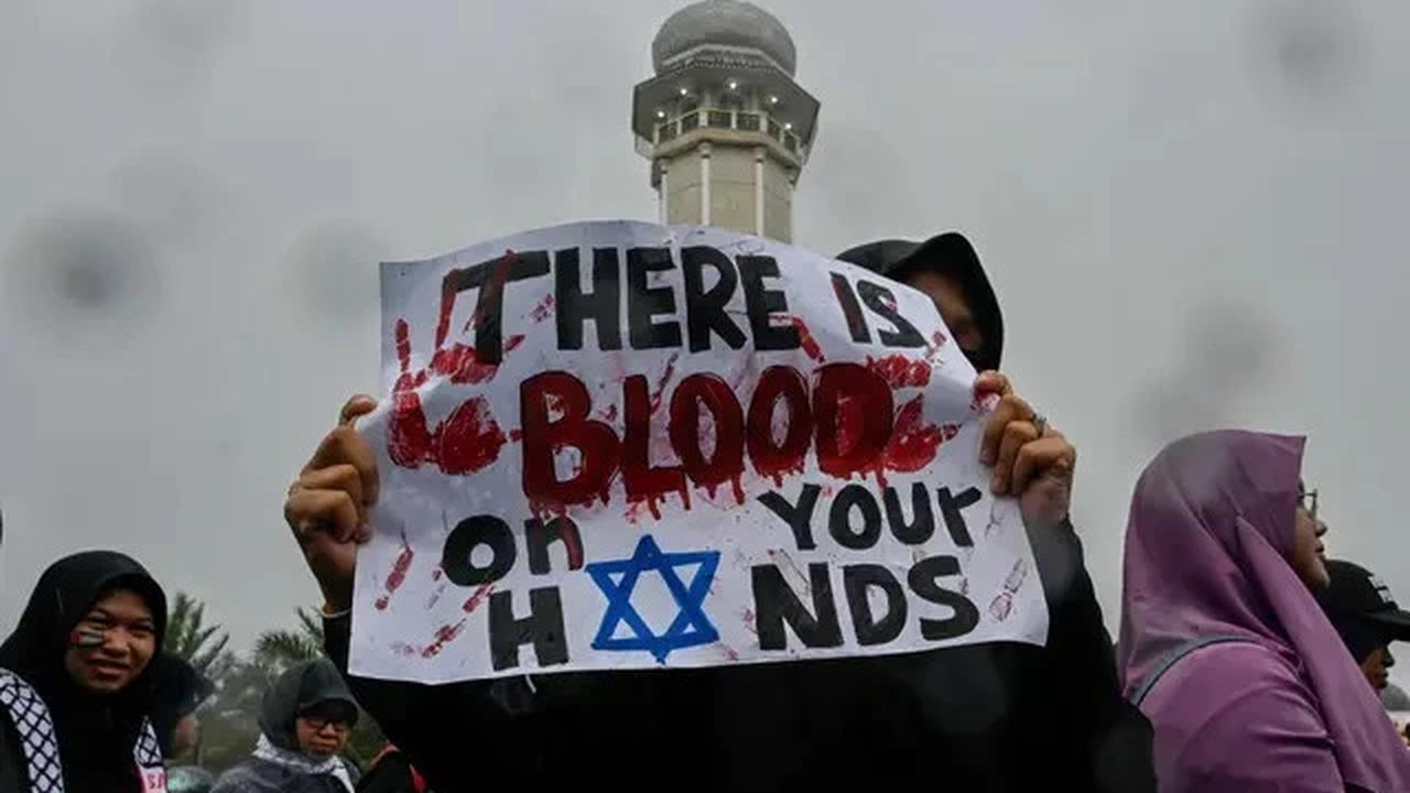 Startup Pakistan Kirim Kaki Prostetik untuk Anak Gaza Korban Serangan Israel