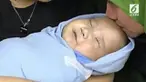 Adam Fabumi adalah bayi yang menginspirasi karena perjuangan hidupnya.
