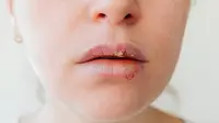 Close up wajah seorang perempuan yang menampilkan bibir kering dan pecah-pecah (Foto Dok: Freepik/zavalishina).