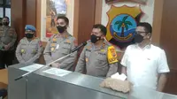 Hidung Mantan Bupati Bolmong Timur Putus Digigit Pengusaha Tambang