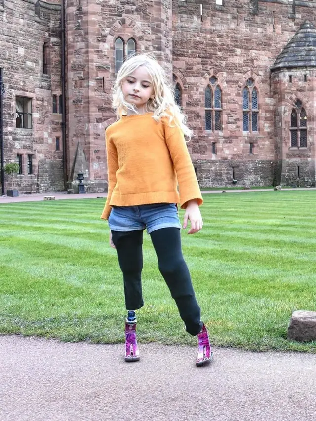 Daisy May, Model Cilik Disabilitas (sumber: instagram/@daisymay_demetre)