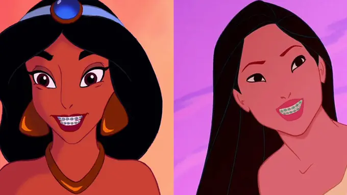 [Bintang] 7 Penampakan Putri Disney Kalau Pakai Behel, Masih Cantik Nggak?