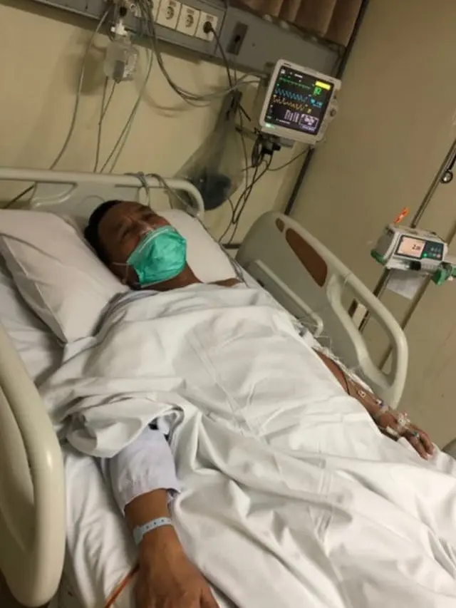 Miing Bagito Jalani Operasi Pengangkatan Batu Empedu