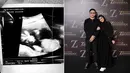 Potret hasil USG tersebut diambil pada 4 Maret 2024 malam, dengan keterangan bayi yang dikandung Nadya Mustika berusia 16 minggu lebih 3 hari. Mengetahui sang istri tengah hamil muda, Iqbal pun menjadi suami yang siap siaga menjaga Nadya. (Liputan6.com/IG/@iqbalfitrahr/@nadyamustikarahayu)