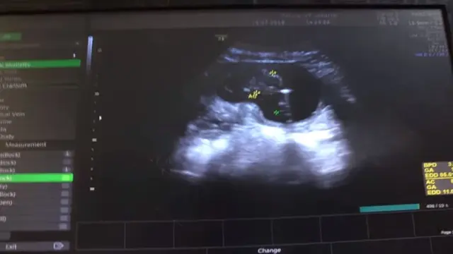Anak dalam Kandungan Istri Rifky Balweel