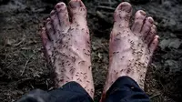 Amor rela kakinya dikerumuni puluhan nyamuk kecil selama 1 menit demi mendapatkan gambaran kehidupan alam liar (Dailymail.com). 