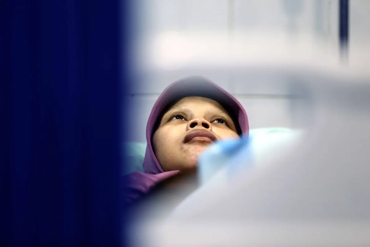 Belum Ada Obat yang Bisa Sembuhkan Sulami Si Manusia Kayu