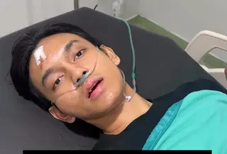 YouTuber Andra ST Usai Kecelakaan (Tangkapan Layar Instagram @andrastyt_)