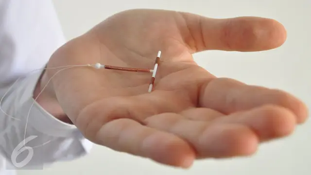 KB IUD
