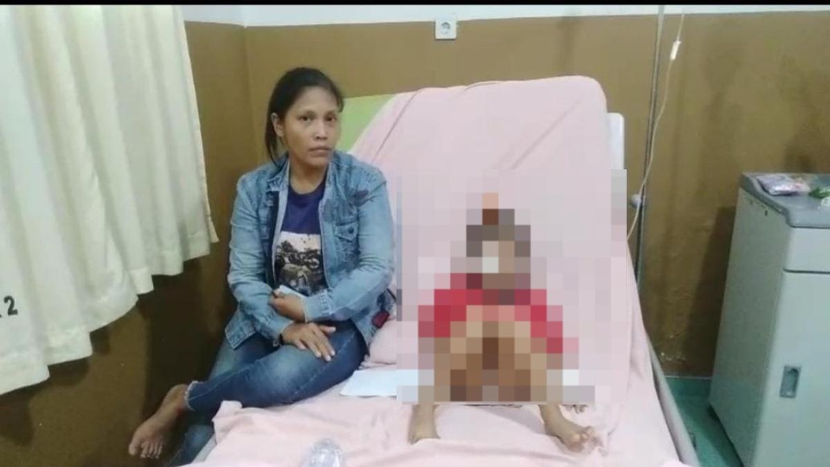 Tawuran Warga Belawan Medan, Peluru Senapan Angin Bersarang di Pelipis Mata Bocah Tak Berdosa