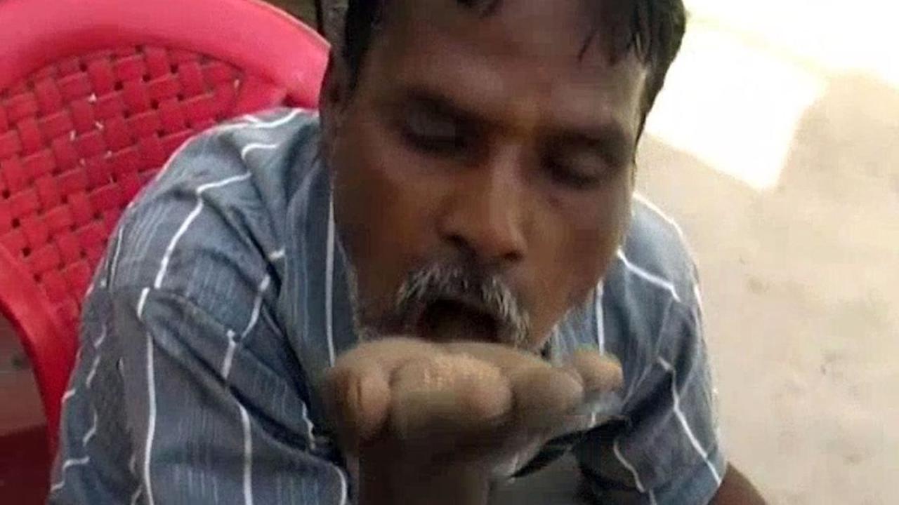 Mengidap Sindrom Pica, Hans Ketagihan Makan Pasir dan Kerikil