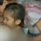 Usai menjalani operasi, usus balita asal samarinda terburai. (Liputan 6 SCTV)