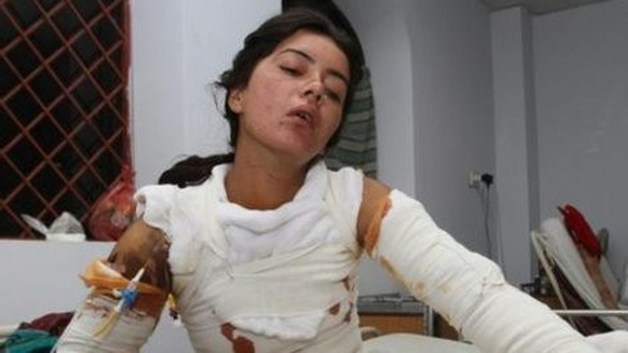 Ogah dipaksa nikah, gadis Pakistan dibakar sampai tewas