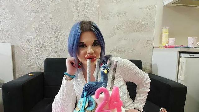 Ingin Tampil Bak Boneka, Wanita Akan Injeksi Bibir Ke 27 Kali Akhir Tahun Ini