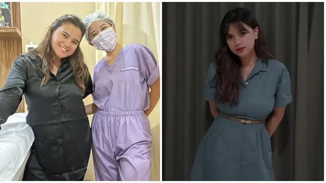 Berat Badan Turun 13 Kg, Ini 6 Potret Terbaru Audi Marissa Dipuji Bak ABG