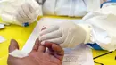 Petugas mengambil sampel darah saat Rapid Test COVID-19 di DPP Partai Golkar, Jakarta, Rabu (8/4/2020). Rapid test memeriksa virus menggunakan antibodi IgG dan IgM yang ada di dalam darah, antibodi akan terbentuk di tubuh saat mengalami infeksi virus. (Liputan6.com/Helmi Fithriansyah)