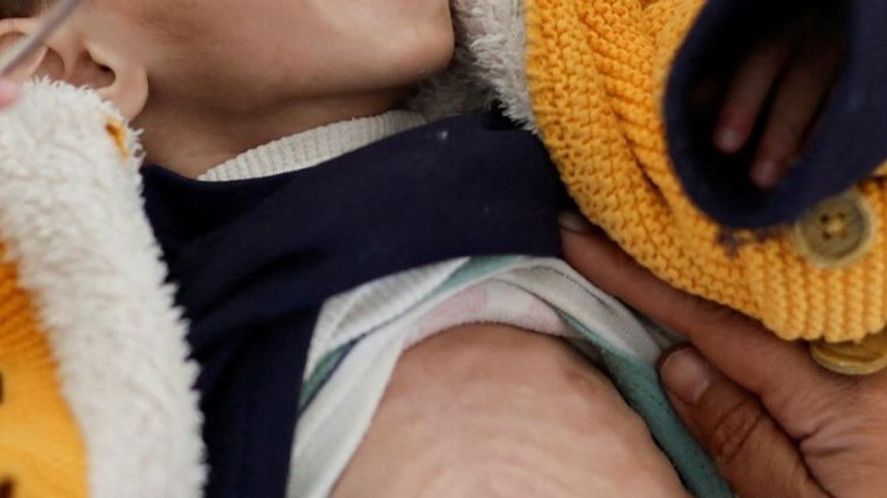 FOTO: Krisis Kelaparan di Gaza Makin Memburuk, Kondisi Anak-Anak Palestina Kurus Menderita Malnutrisi Akut di Rumah Sakit