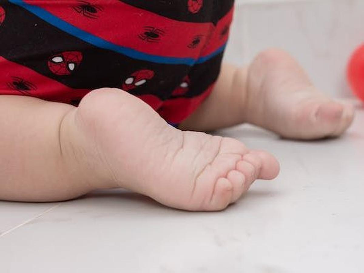 4. Pigeon Toes