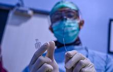 Dokter Ungkap Penyebab Serangan Jantung Kini Banyak Menyerang Usia Muda