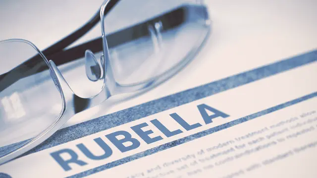 Gejala dan Penyebab Anak Terserang Virus Rubella