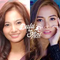 Penampilan dulu dan kini Acha Septriasa. (Istimewa, Instagram/achaseptriasa)