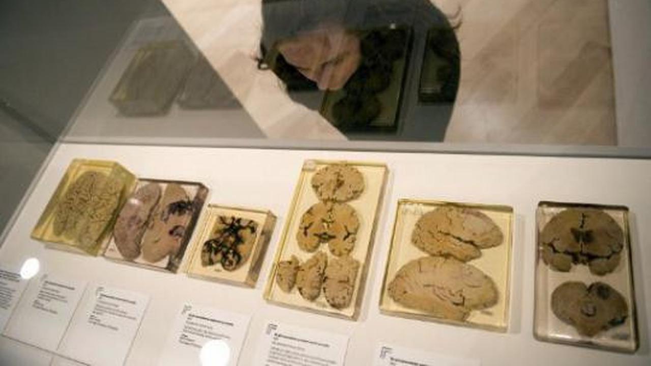 Pameran koleksi otak di London