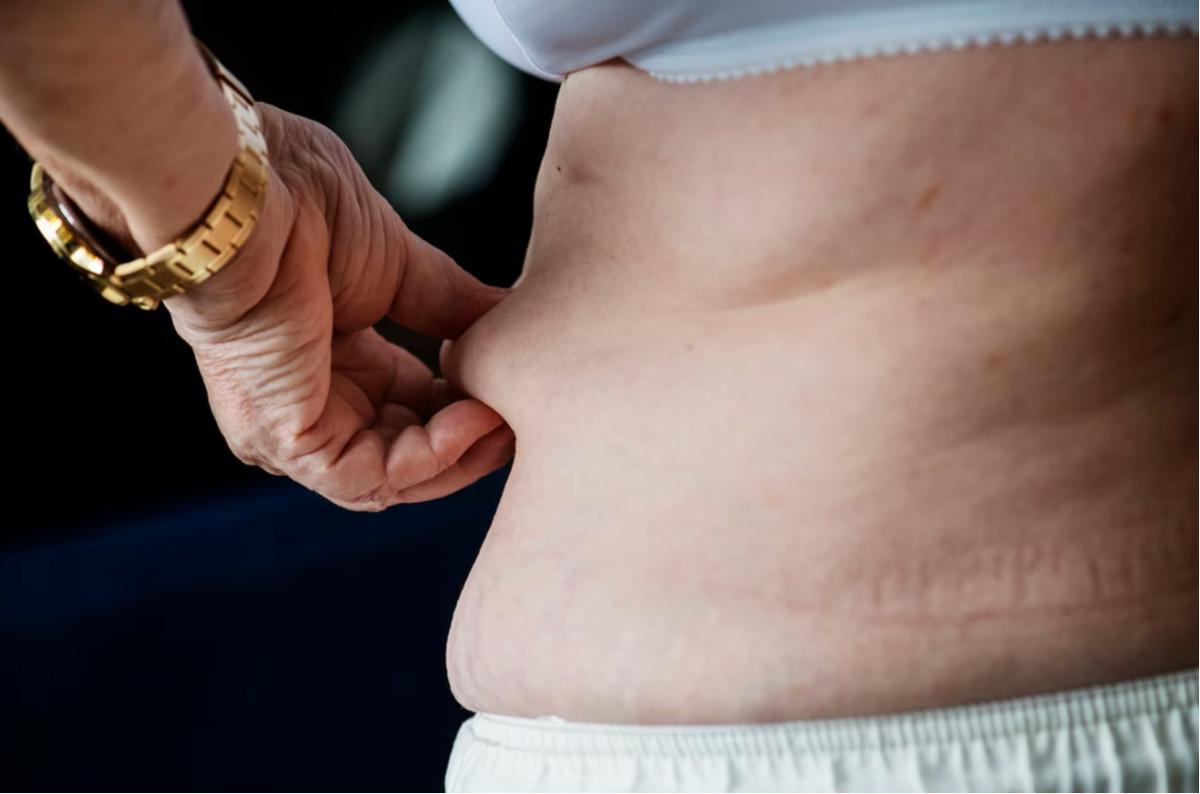 Diet atau Gaya Hidup? Menyelami Keuntungan Intermittent Fasting