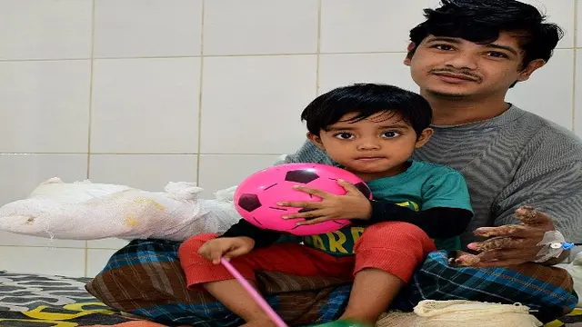 Abul Bajandar Manusia Pohon