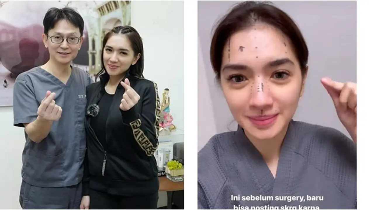 8 Potret Angel Karamoy Jalani Operasi Plastik di Korea Selatan, Curi Perhatian