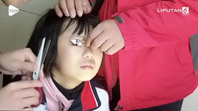 VIDEO: Mata Siswi SMP Tersangkut Resleting Seragam Sekolah