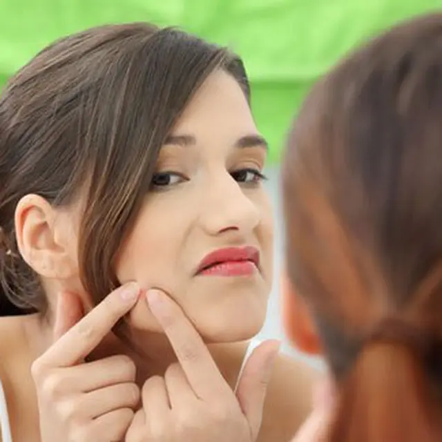 25 Cara Menghilangkan Jerawat Di Wajah Secara Cepat Dan Alami Beauty Fimela Com