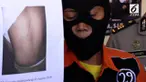 Ayah pergi bekerja seorang Ibu menganiaya anak tiri hingga lebam