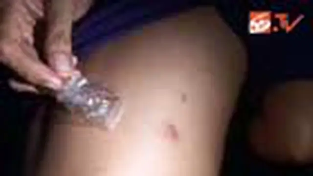 Bocah di Polewali Terkena Serangan Tomcat