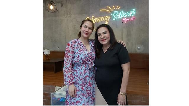 6 Potret Penampilan Terbaru Mpok Atiek Pasca 21 Kali Operasi Pengangkatan Silikon