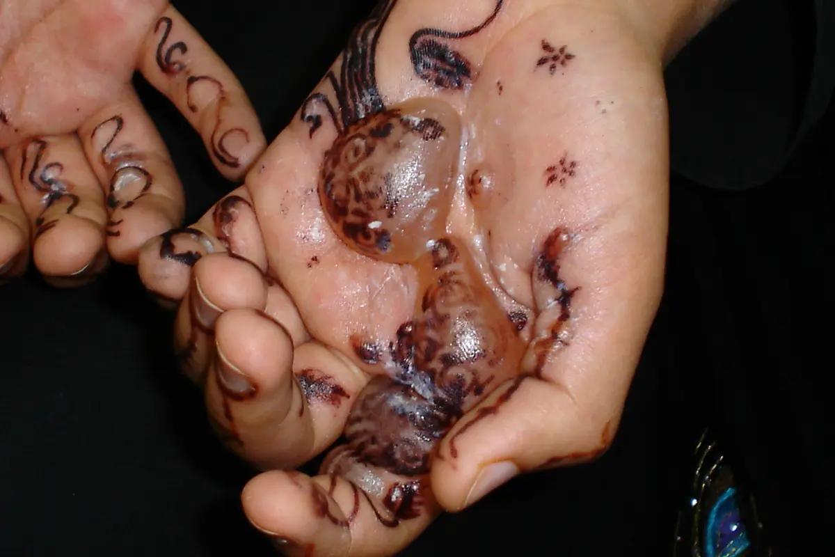 [Bintang] Bukannya Cantik, Hal Mengerikan Terjadi Usai Pakai Henna Hitam