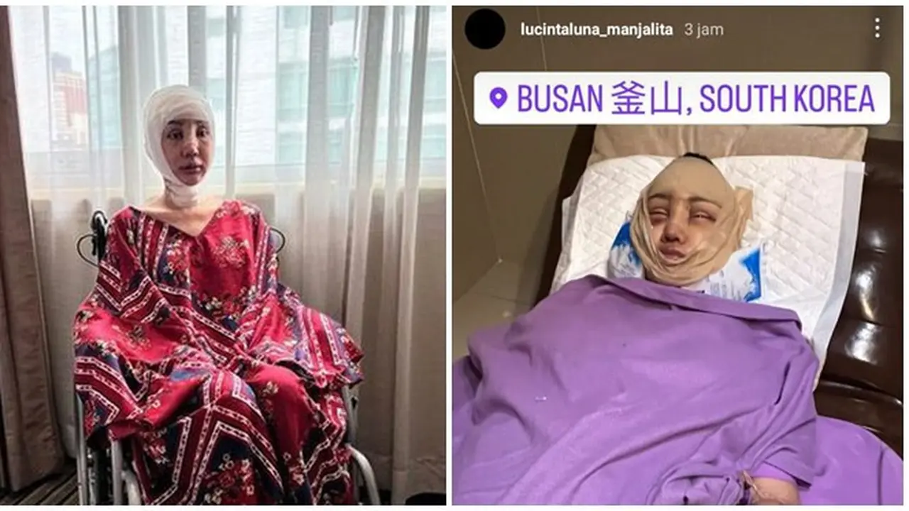 8 Potret Lucinta Luna Kembali Jalani Operasi Plastik, Curi Perhatian