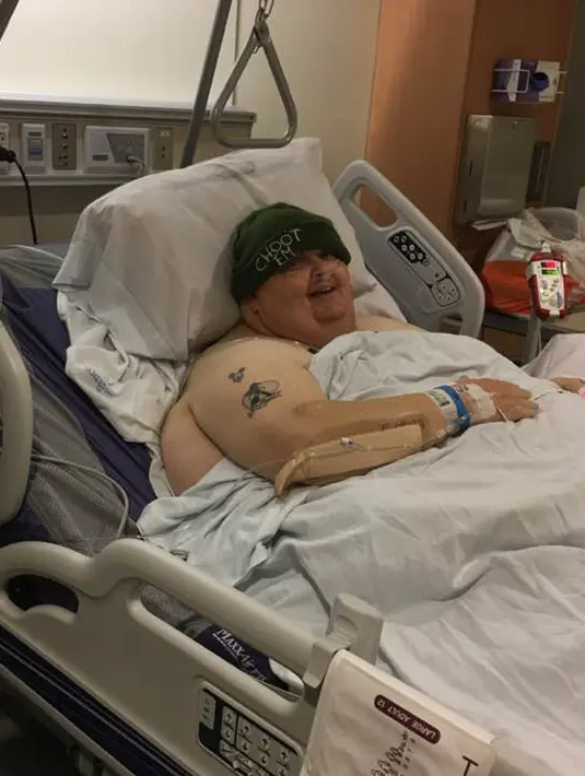 Roger Logan tengah menjalani perawatan usai pengangkatan tumor di RS Bakersfield Memorial, California.  Tim dokter menduga tumor seberat 58,97 kilogram itu disebabkan oleh rambut yang tumbuh di dalam kulit dan mengalami infeksi. (facebook.com/reddyrog)