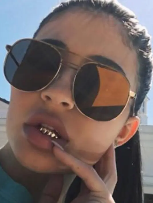 Bukanlah lantaran Kylie jarang menggosok giginya, melainkan dirinya memasang gigi emas layaknya mantan kekasihnya, Tyga. (@kyliejenner/Bintang.com)