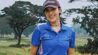 Anya Geraldine berpose di lapangan golf. Pose pede dengan memegang tongkat golf sebagai tumpuan membuat tampilannya semakin cantik.
Selain itu Anya terlihat Manis saat tersenyum gigi ditambah topi hitam untuk melengkapi gaya pakaiannya. Netizen pun dibuat terpesona hingga gagal fokus dengan sosoknya. (Instagram/anyageraldine)