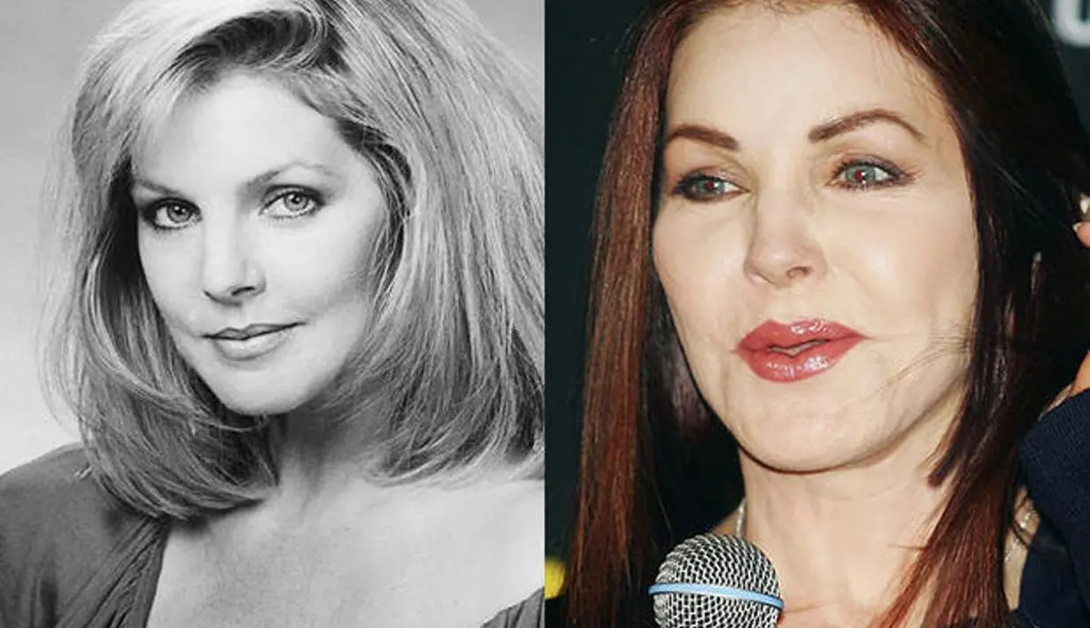 Priscilla Presley melakuan suntik silkon di pipinya. Sekarang wajahnya malah terlihat tidak secantik dulu pasca operasi. (CBS)