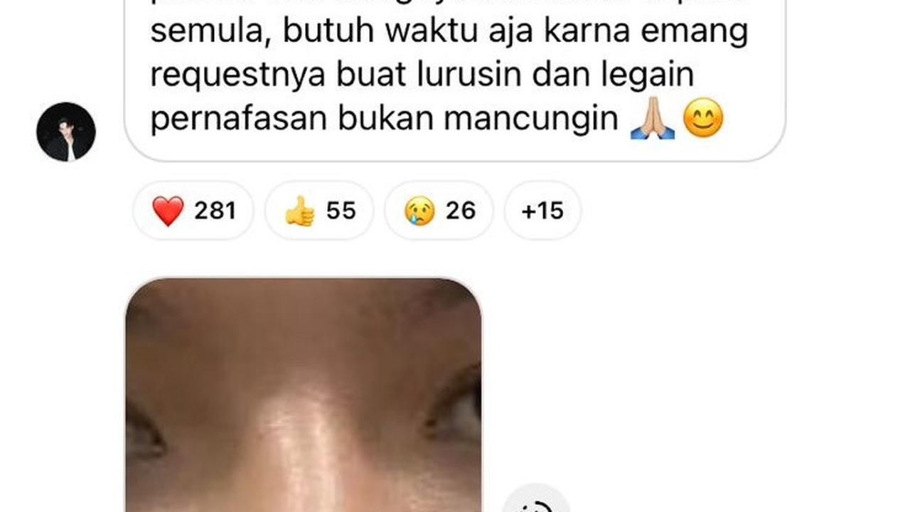 7 Potret Terbaru Rey Mbayang yang Benarkan Oplas Hidung, Alasannya Masalah Kesehatan