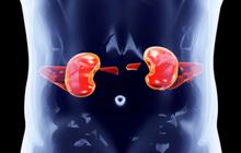 Penyakit Addison: Mengatasi Insufisiensi Adrenal Melalui Diagnosis dan Perawatan yang Efektif