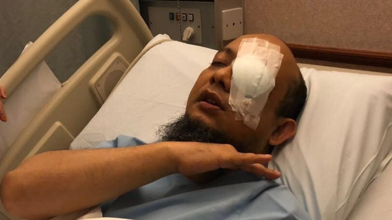 Kondisi terakhir penyidik KPK Novel Baswedan (Dok: Dahnil Anzar Simanjuntak)