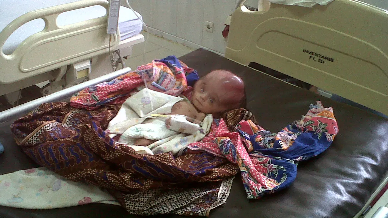 Setelah ditolak dan terlantar, Bayi Hanafi Akhirnya Diterima Ruma