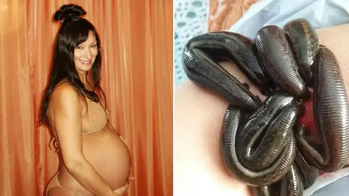 Tingkatkan Orgasme, Wanita Ini Masukan Lintah ke Vaginanya