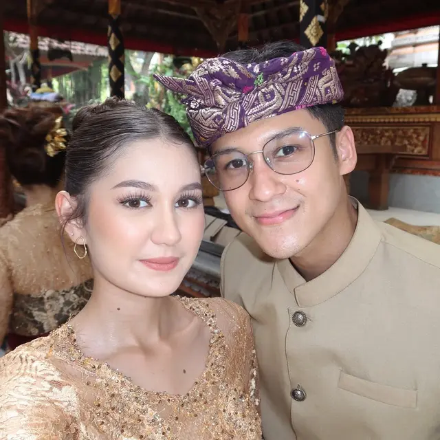6 Potret Zoe Jackson di Pernikahan Kakak Antonio Blanco, Didoakan Segera Menyusul