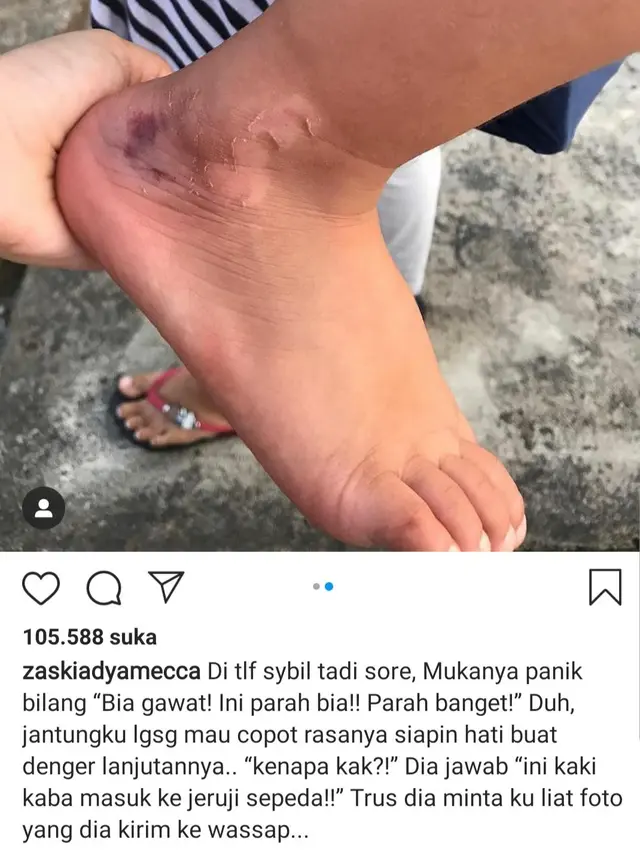 Unggahan Zaskia Adya Mecca. (Foto: Instagram @zaskiadyamecca)
