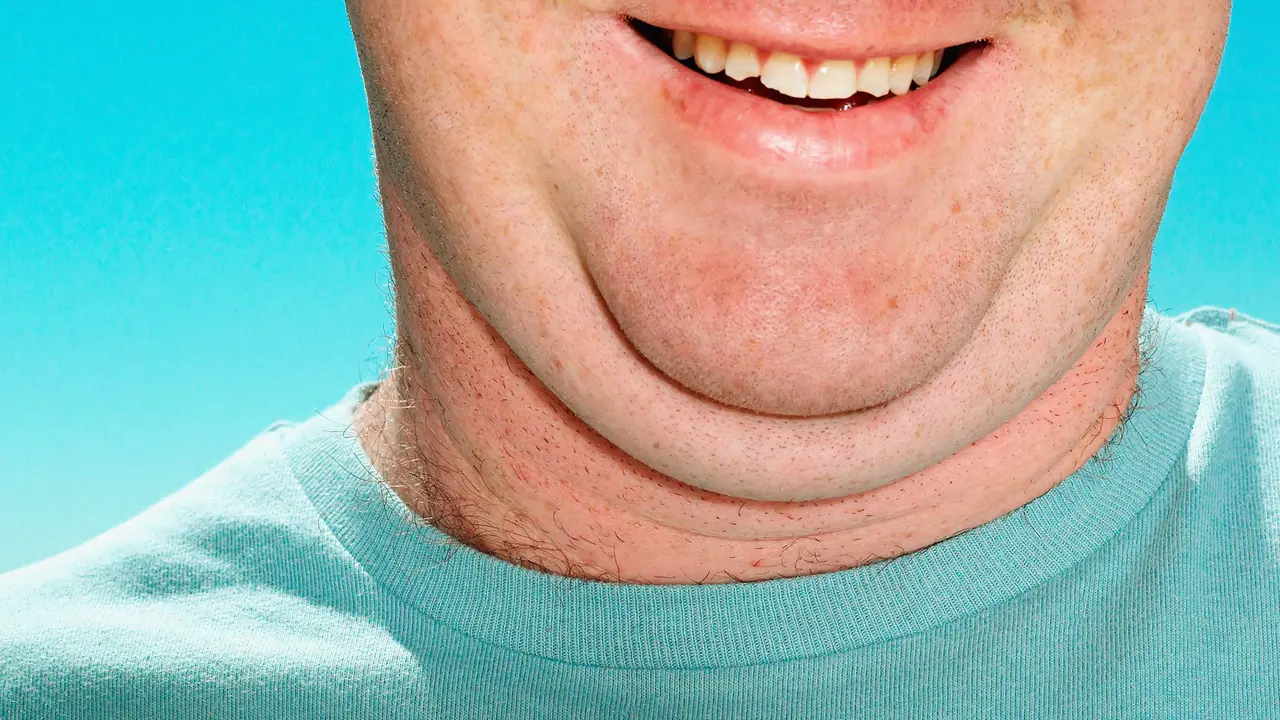 Double Chin