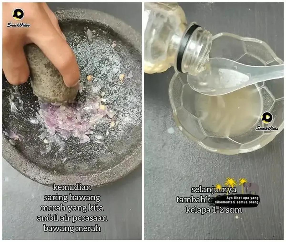 Cara Menumbuhkan Rambut Rontok Secara Alami, Cukup Gunakan 2 Bahan